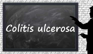 Statine bei Colitis ulcerosa
