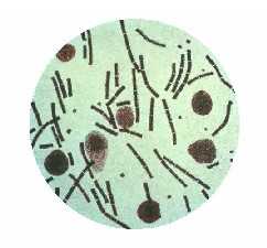 Anthrax Bakterien