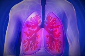 Nicht-kleinzelliger Lungenkrebs: Keytruda verlängert krankheitsfreies Überleben