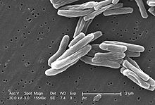 Tuberkulose: 8-wöchige Bedaquilin-Linezolid-Behandlung nicht unterlegen